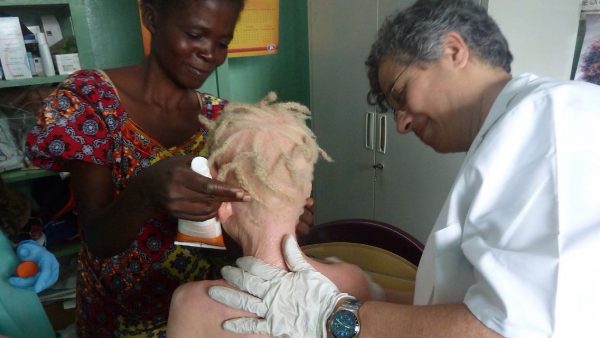 La Dra. Torres atendiendo a una persona con albinismo
