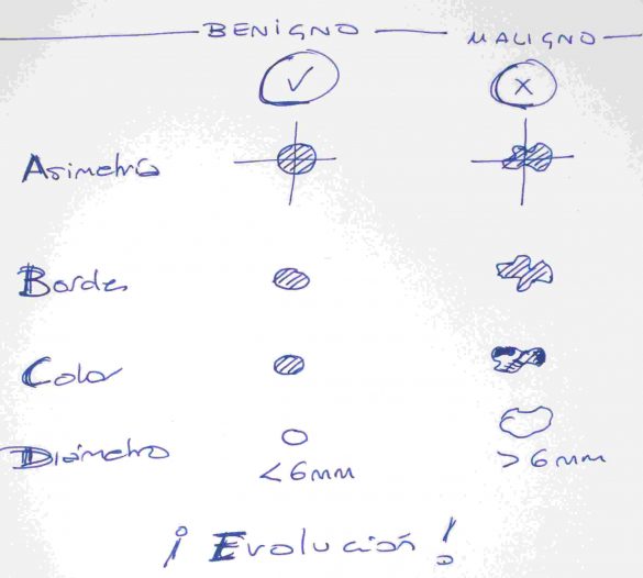 Regla ABCDE para lunares