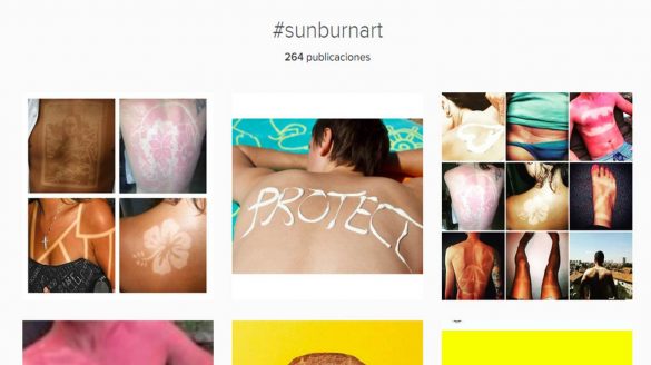 instagram sunburn art