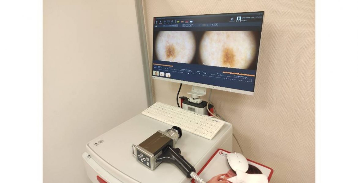dermatoscopia digital