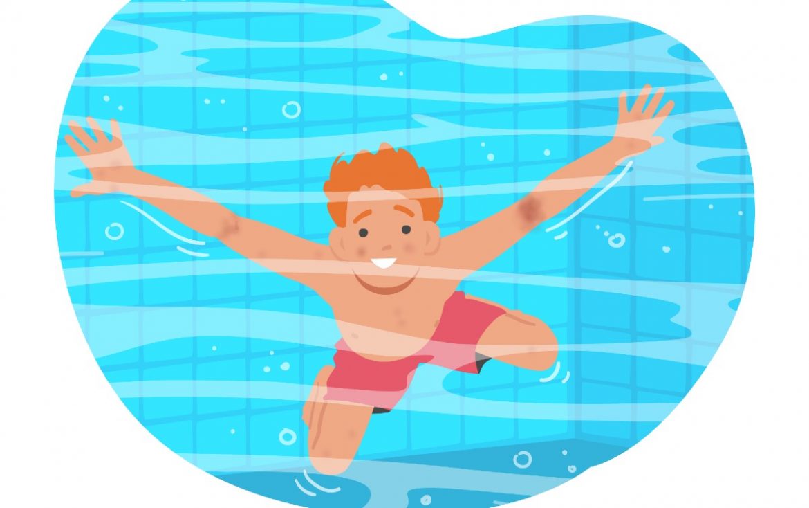 piscina y dermatitis atópica